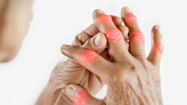 Artrosis y artritis: cuáles son las diferencias y cómo detectarlas