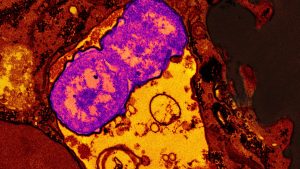 La amenaza de las superbacterias: Naciones Unidas tratará el problema 