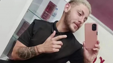 Murió un joven argentino tras contraer viruela del mono en México.