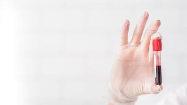 Un análisis de sangre podría determinar si el paciente tiene depresión, según recientes estudios. 