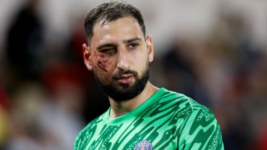 Malas noticias para Donnarumma tras la tremenda patada que sufrió en el partido entre PSG y Mónaco