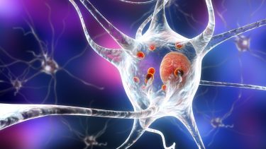 Las enfermedades neurodegenerativas son un grupo de dolencias que afectan al sistema nervioso central y/o periférico.  Crédito: Kateryna Kon